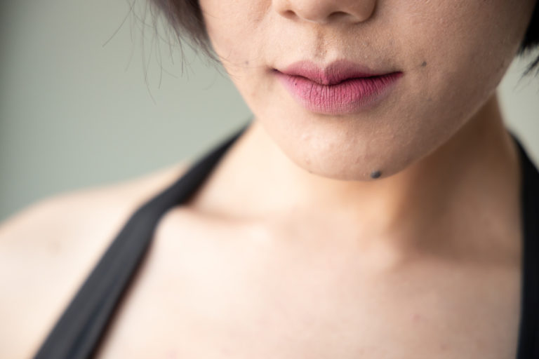 Que mettre sur un grain de beauté qui gratte ? Un grain de beauté qui gratte.